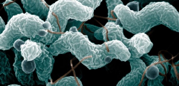 Las infecciones por consumo de productos crnicos encabezan el ranking de ETA en Estados Unidos