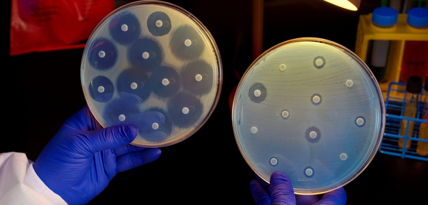 La FAO pide una accin internacional frente a la resistencia a los antimicrobianos